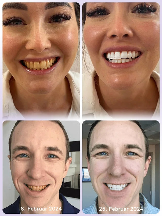restauracion de la salud periodontal de essencia mineral
