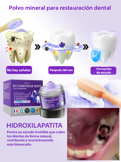 restauracion de la salud periodontal de essencia mineral