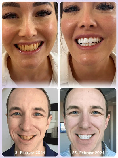 restauracion de la salud periodontal de essencia mineral