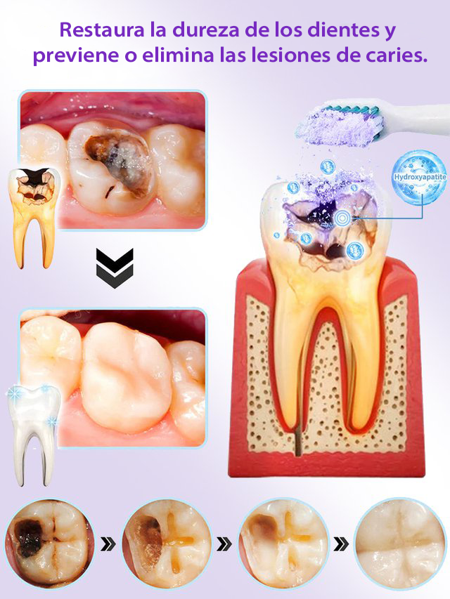 tooth
